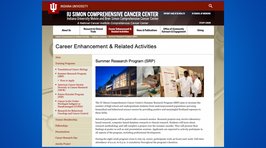 Indiana University Simon Cancer Center Summer Research Program